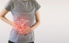 Frau fasst sich an den Bauch